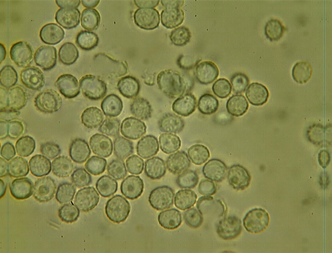 spores
